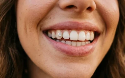 Gemme dentali: cosa sono, come si applicano e perché piacciono così tanto